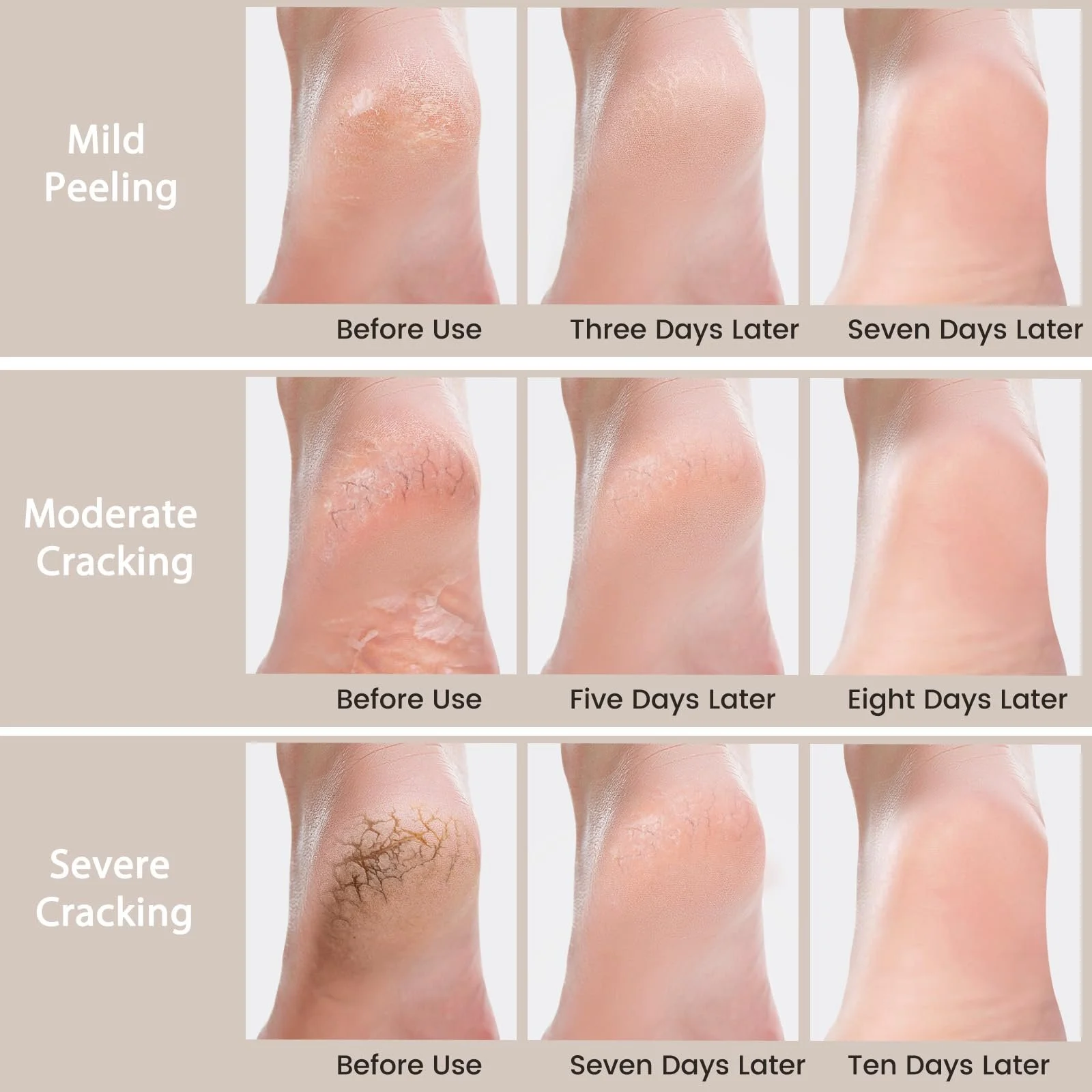 Крем для ног Urea 40% 150 г, фото №6