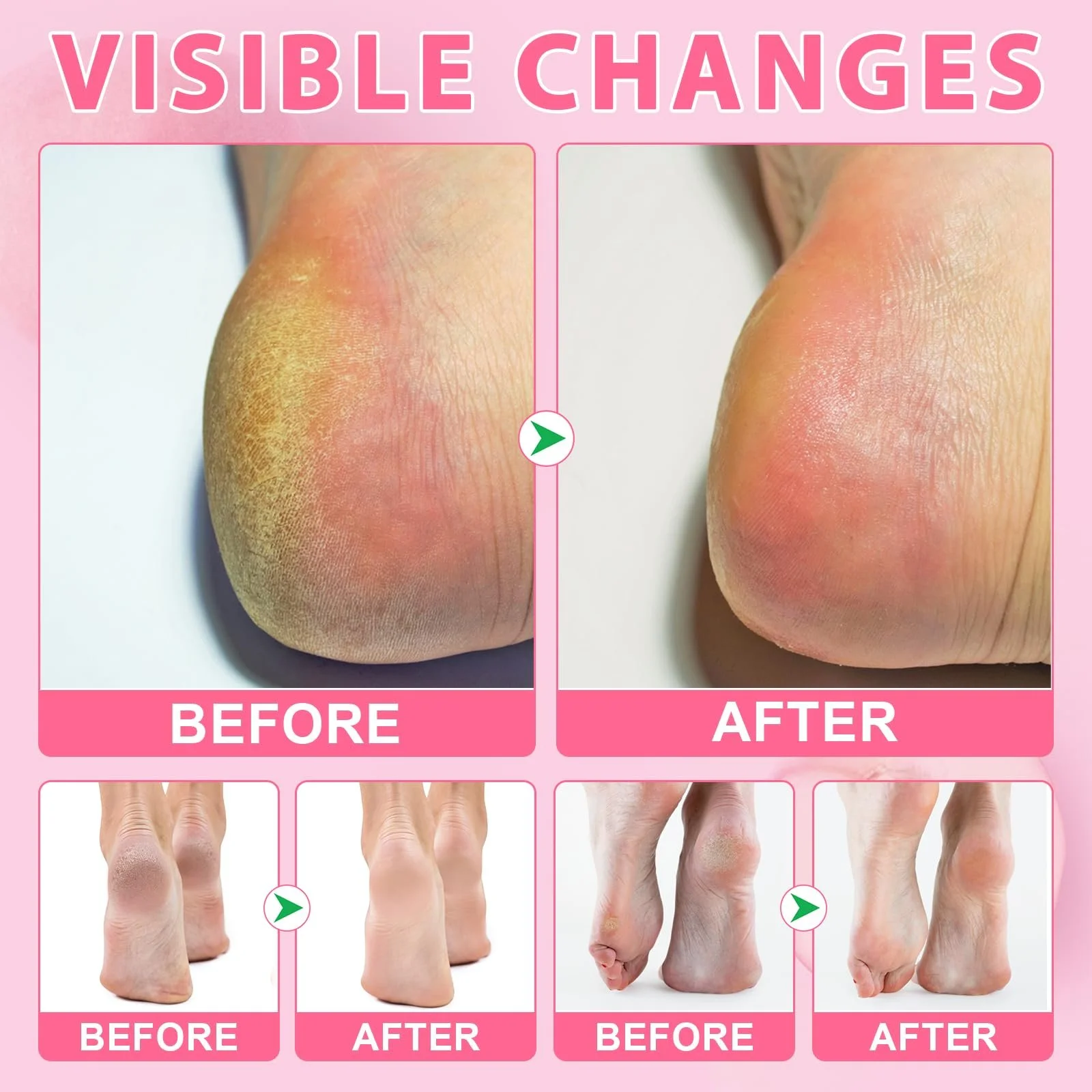 Стик-бальзам для восстановления пяток Cracked Heel Repair Smooth Peach Taste с мочевиной и салициловой кислотой увлажняющий, фото №7