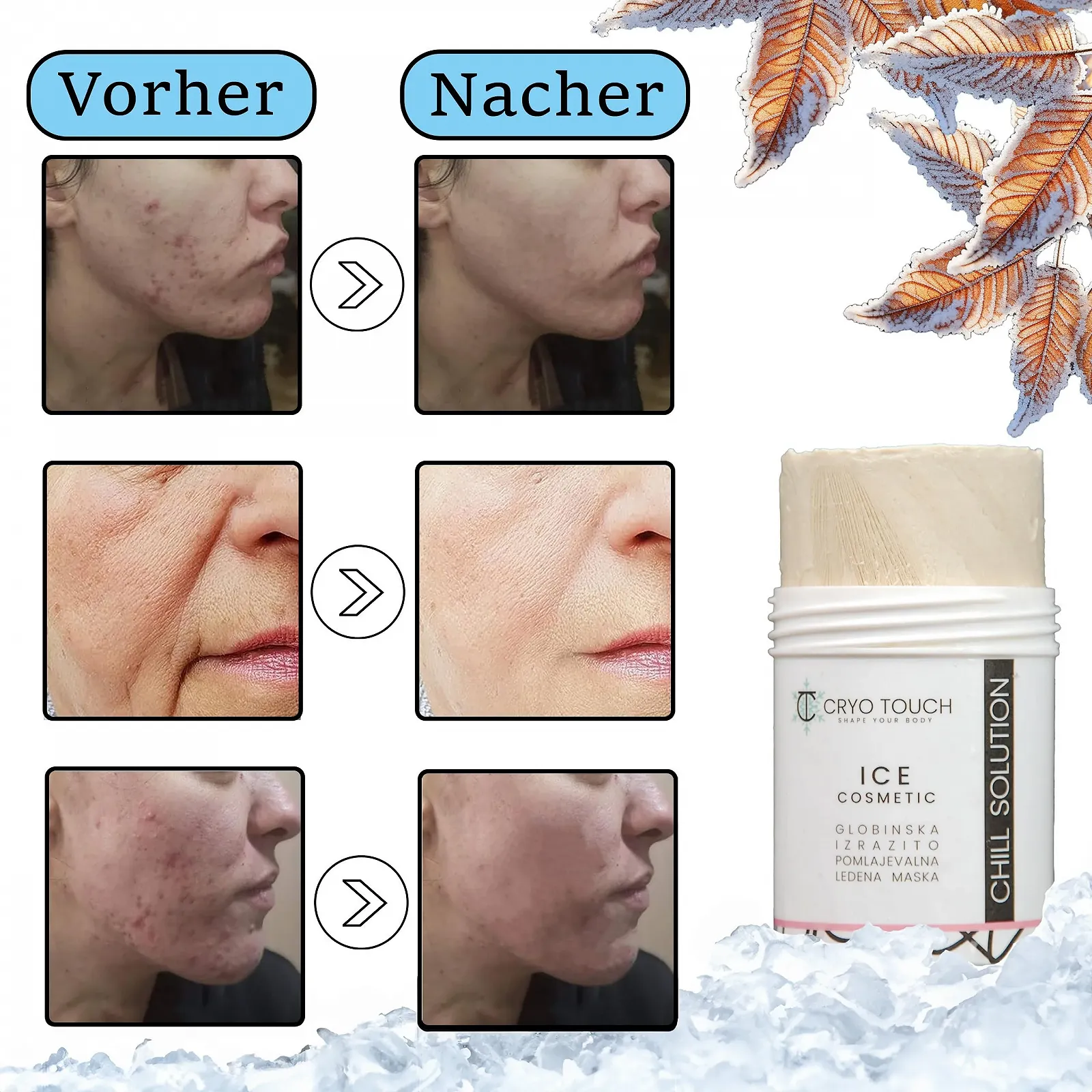 Маска для лица Beauty Chill Solution, косметическая ледяная маска, упакована в баночке push-up 65 г, замороженная маска для лица - заморозьте гель и используйте, гель обогащен глиной - каолин, алоэ, календула и E, фото №5 Маска для лица Beauty Chill Solution, косметическая ледяная маска, упакована в баночке push-up 65 г, замороженная маска для лица - заморозьте гель и используйте, гель обогащен глиной - каолин, алоэ, календула и E, фото №5