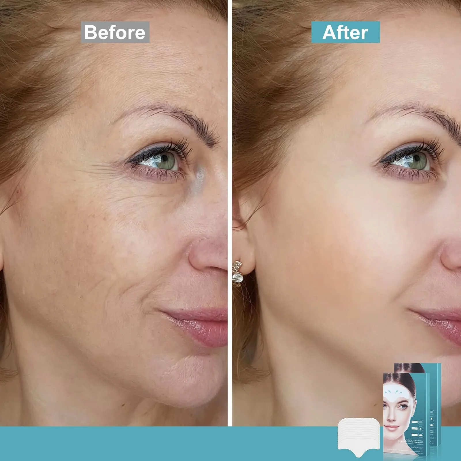 Пластыри от морщин, упаковка 20 шт для увлажнения кожи., фото №3