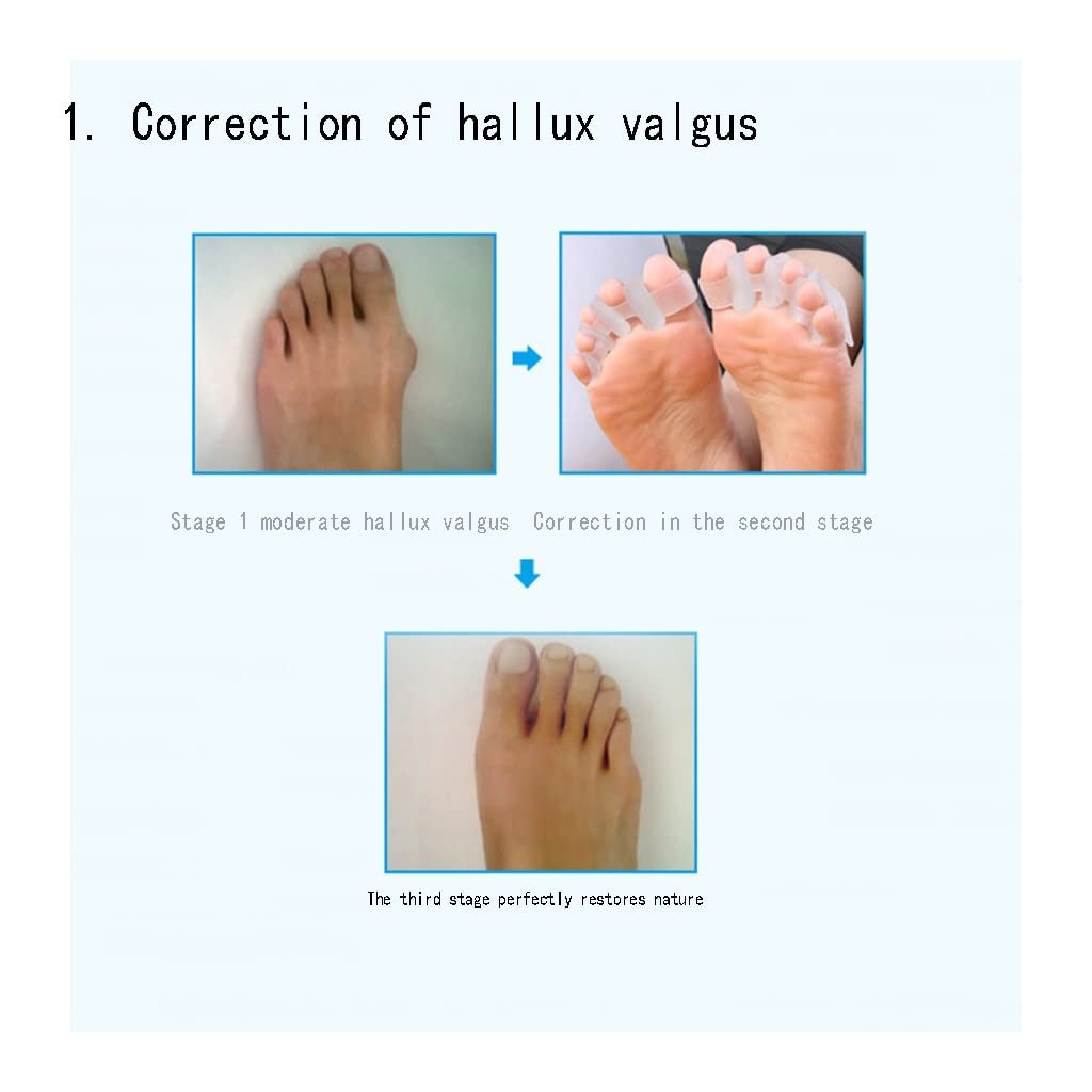 Роздільник для пальців ніг Гелевий CAZARU для перекриваючихся пальців ніг, простий у носінні у взутті, фото №3