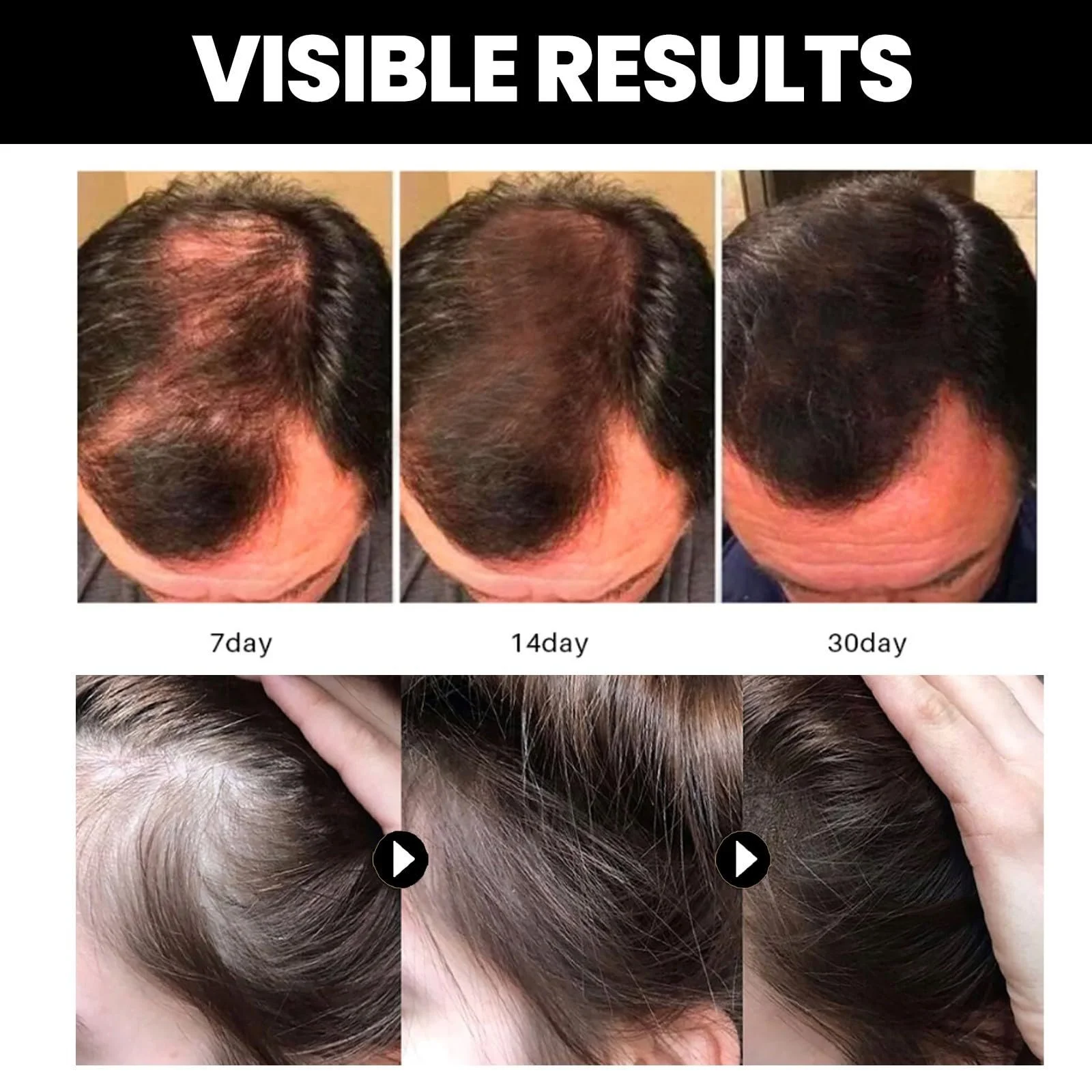 Органічна Батанова Олія для росту волосся Premium 100% Натуральна, фото №7 Органічна Батанова Олія для росту волосся Premium 100% Натуральна, фото №7