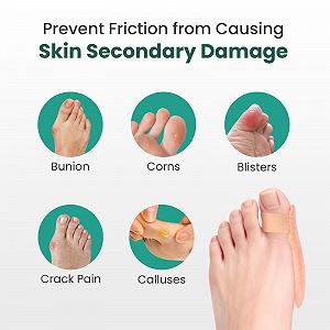 Подушечка для захисту кісточки Welnove, бежева, 6 штук в упаковці synthetic.ua - Фото 1