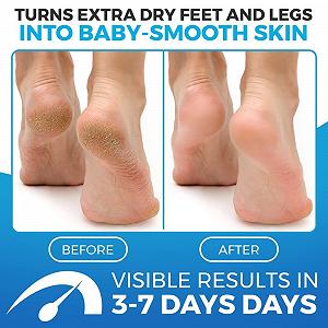 Бальзам для ніг Imperial Feet Blue для сухої шкіри 150 мл synthetic.ua - Фото 1