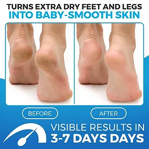 Бальзам для ніг Imperial Feet Blue для сухої шкіри 150 мл synthetic.ua - Фото 1