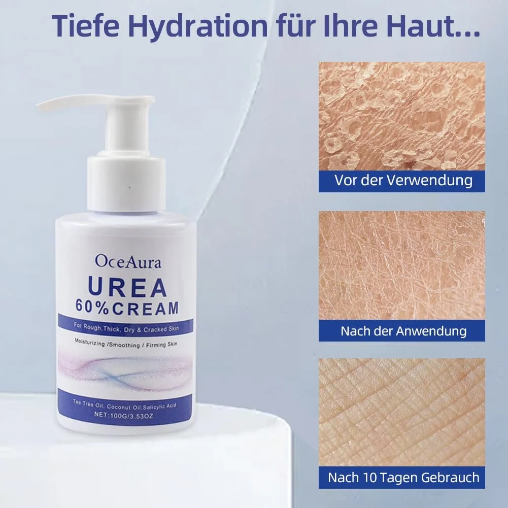Крем с мочевиной 60% и салициловой кислотой для ног и рук против мозолей и трещин, фото №2
