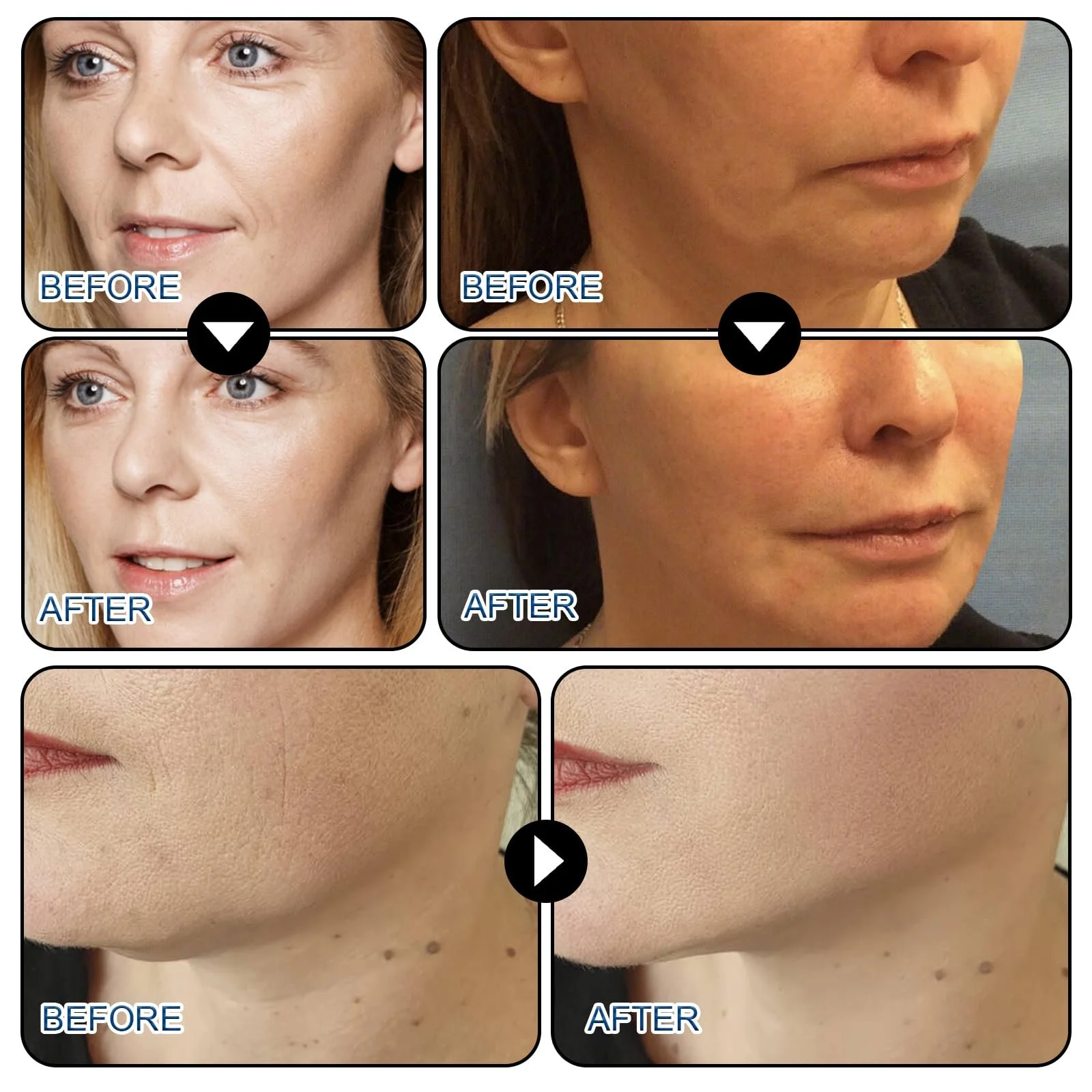 Тейп для обличчя Паковання з 80 шт. Прозорий, фото №2