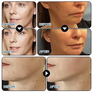 Тейп для обличчя Паковання з 80 шт. Прозорий synthetic.ua - Фото 1