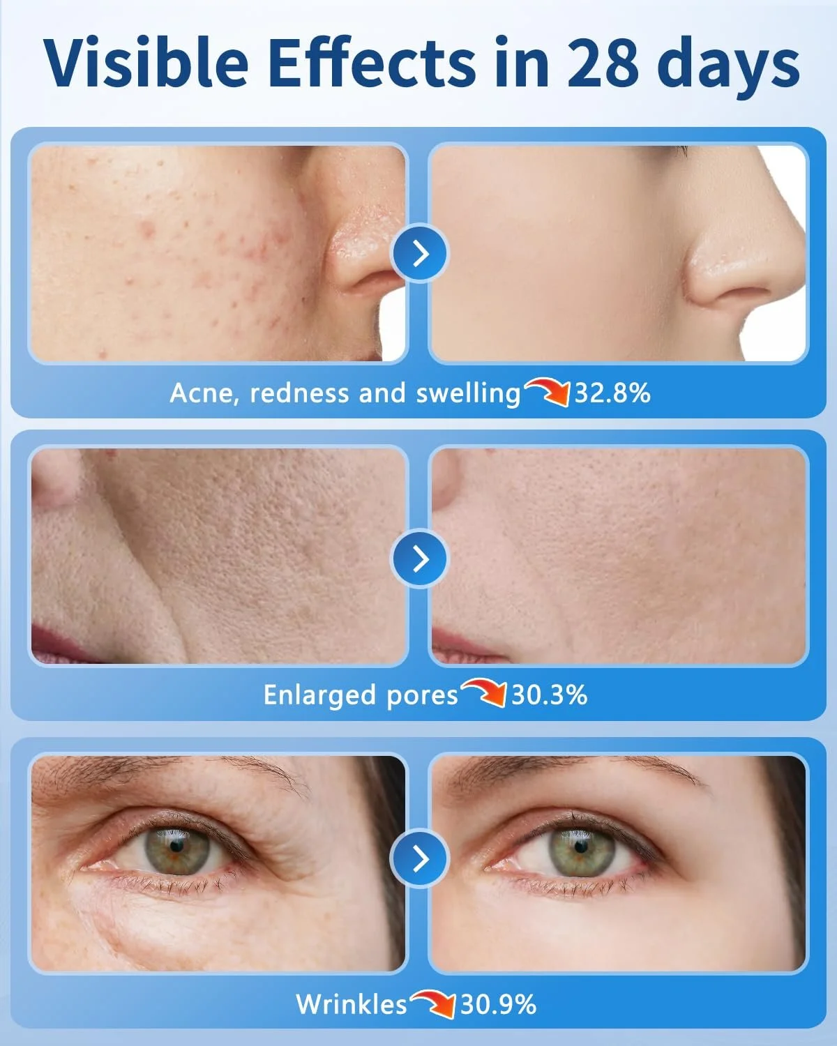 LED Маска для обличчя Світлотерапія Червоне світло для обличчя 7 кольорів, фото №6 LED Маска для обличчя Світлотерапія Червоне світло для обличчя 7 кольорів, фото №6