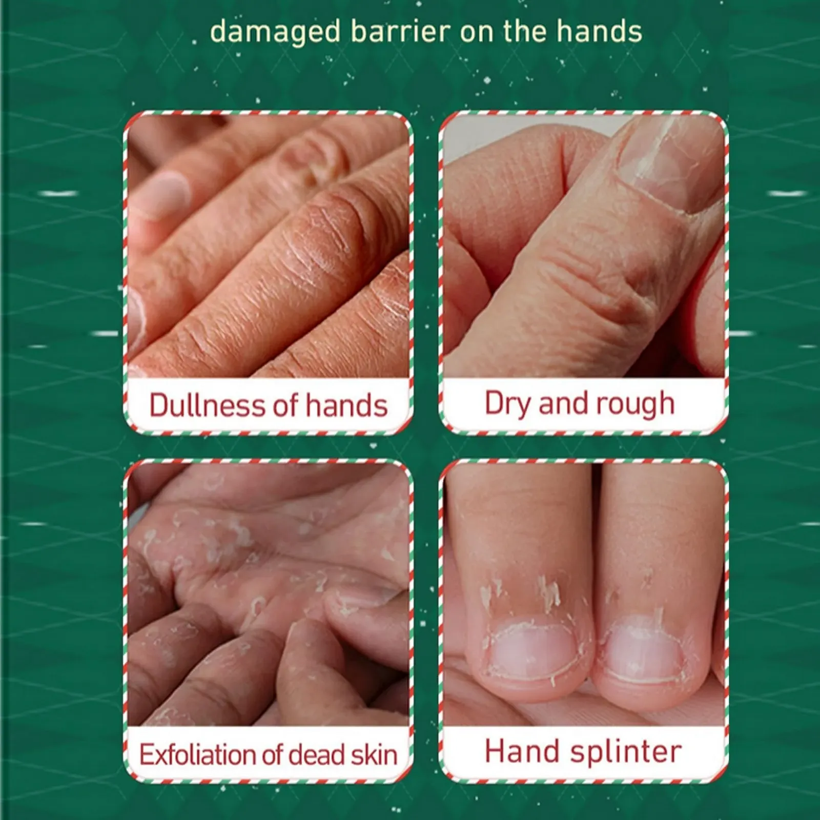 Крем для рук Рождественские подарки для сухих потрескавшихся рук, Увлажняющее средство для зимы, Небольшой набор лосьонов для рук для женщин и мужчин, Увлажняющее средство для рук и ног, фото №2