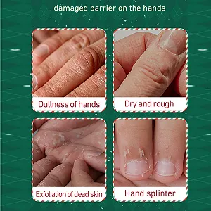 Крем для рук Рождественские подарки для сухих потрескавшихся рук, Увлажняющее средство для зимы, Небольшой набор лосьонов для рук для женщин и мужчин, Увлажняющее средство для рук и ног synthetic.ua - Фото 1