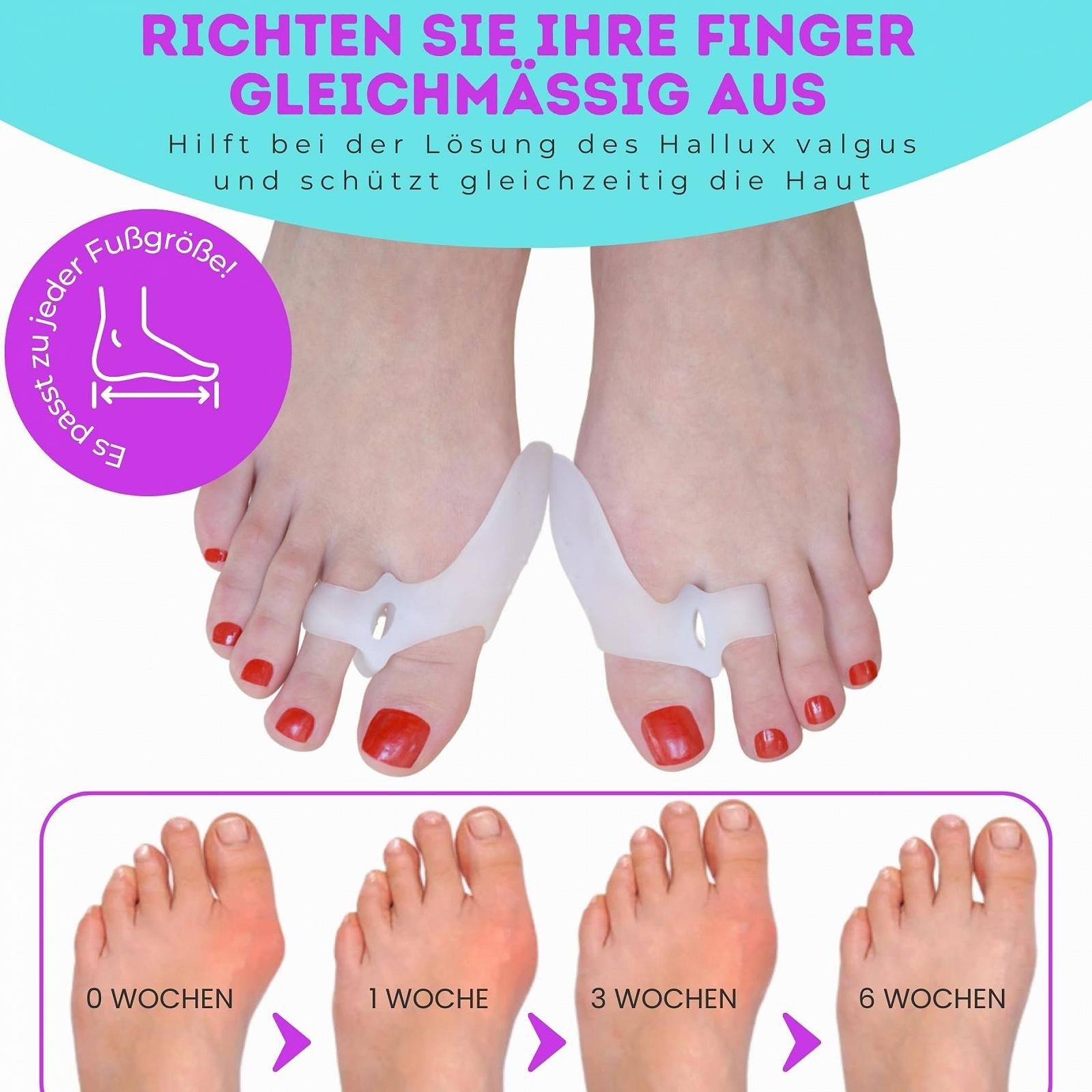 Шина Hallux Valgus з м'яким та лікувальним силіконовим протектором для кісточки 6 штук Білий, фото №2 Шина Hallux Valgus з м'яким та лікувальним силіконовим протектором для кісточки 6 штук Білий, фото №2