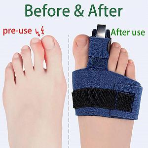 Коректор для молоткоподібних пальців, набір synthetic.ua - Фото 1