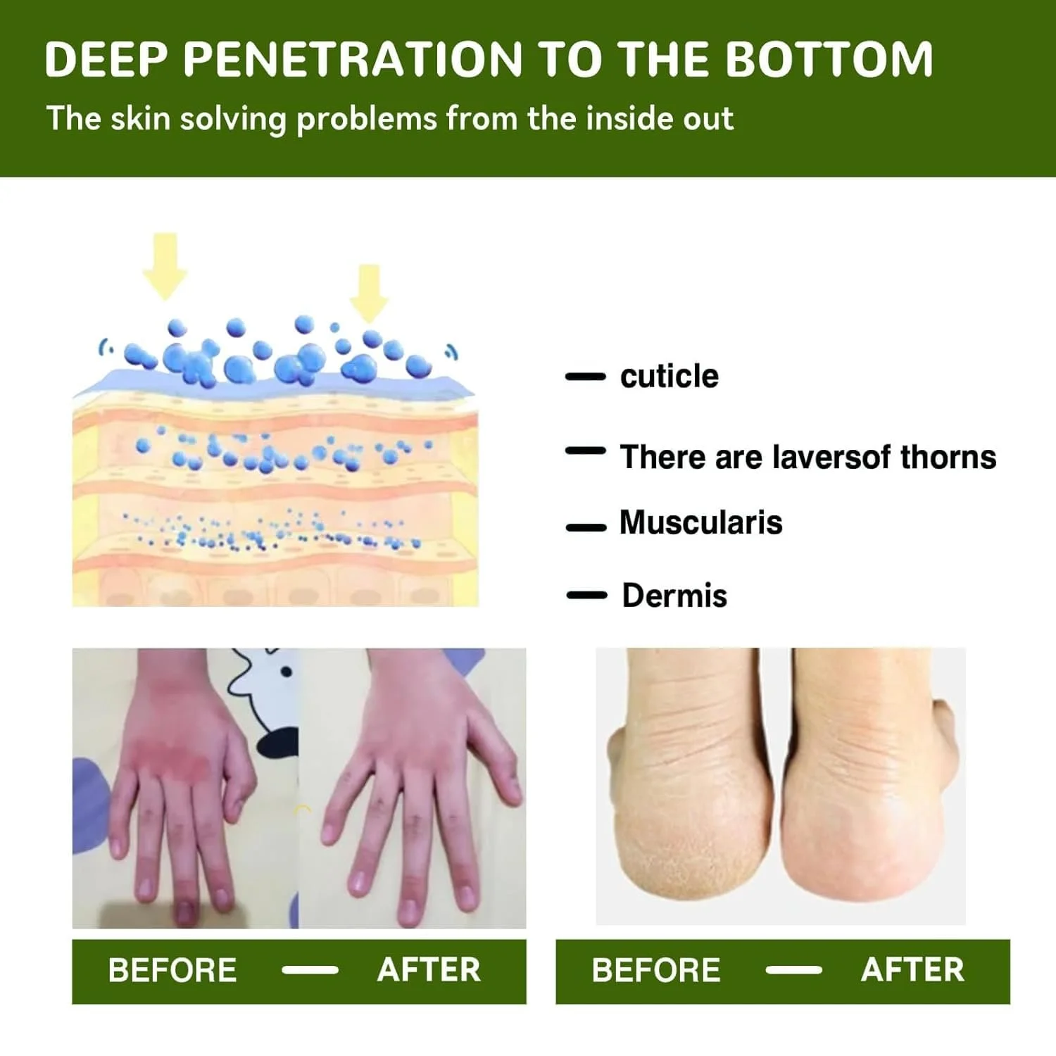 Крем для ног Hydrating and Anti-Cracking увлажняющий от трещин и сухости, фото №6