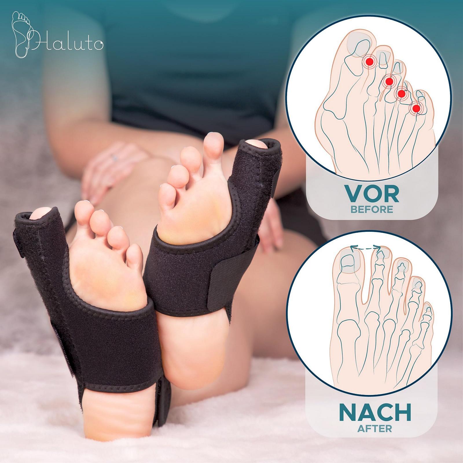 Шина Hallux Valgus HALUTO для корекції Hallux Valgus Ефективна шина, фото №5