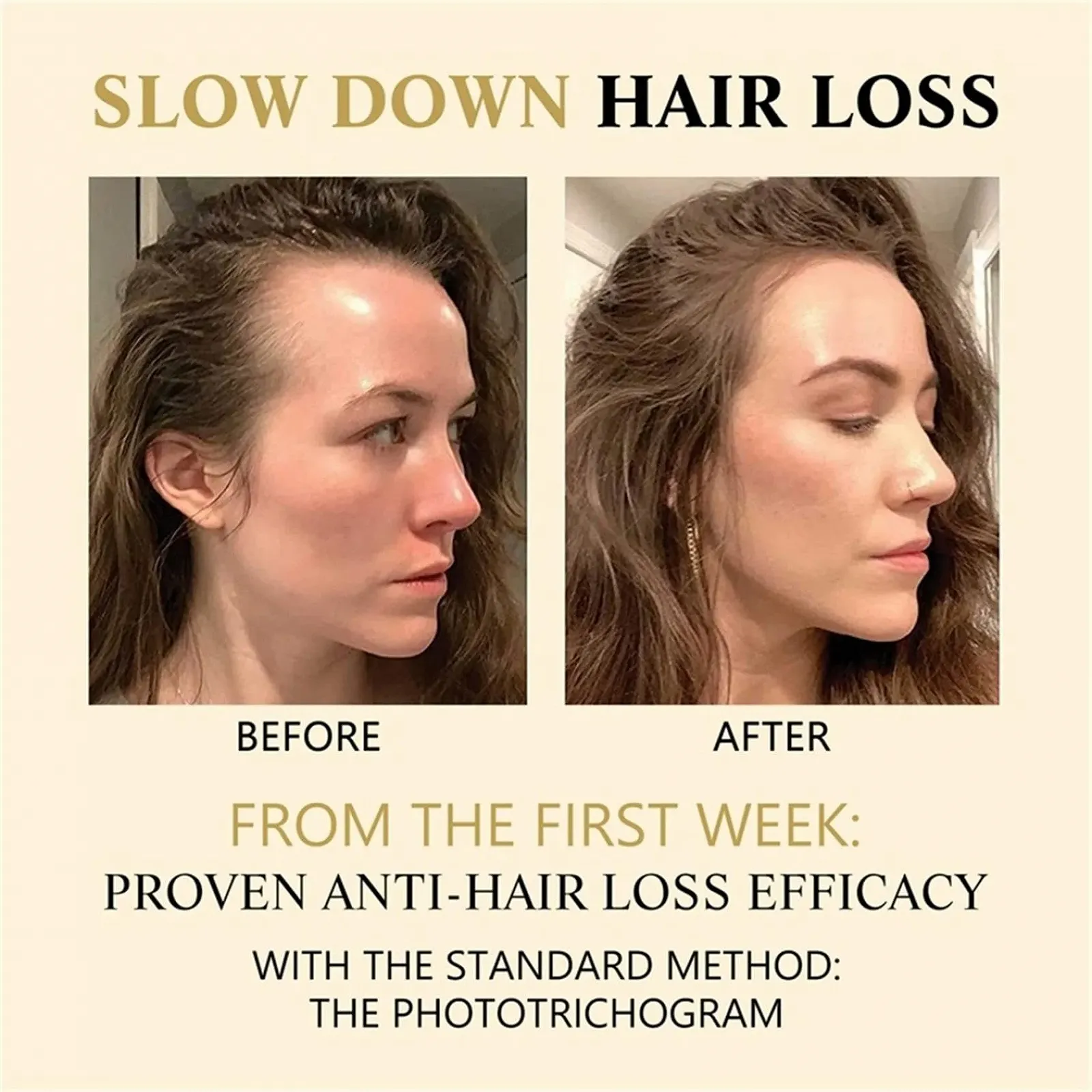 Есенція-ролик для росту волосся з біотином Biotin, сироватка для прискорення росту волосся (3 штуки), фото №6 Есенція-ролик для росту волосся з біотином Biotin, сироватка для прискорення росту волосся (3 штуки), фото №6