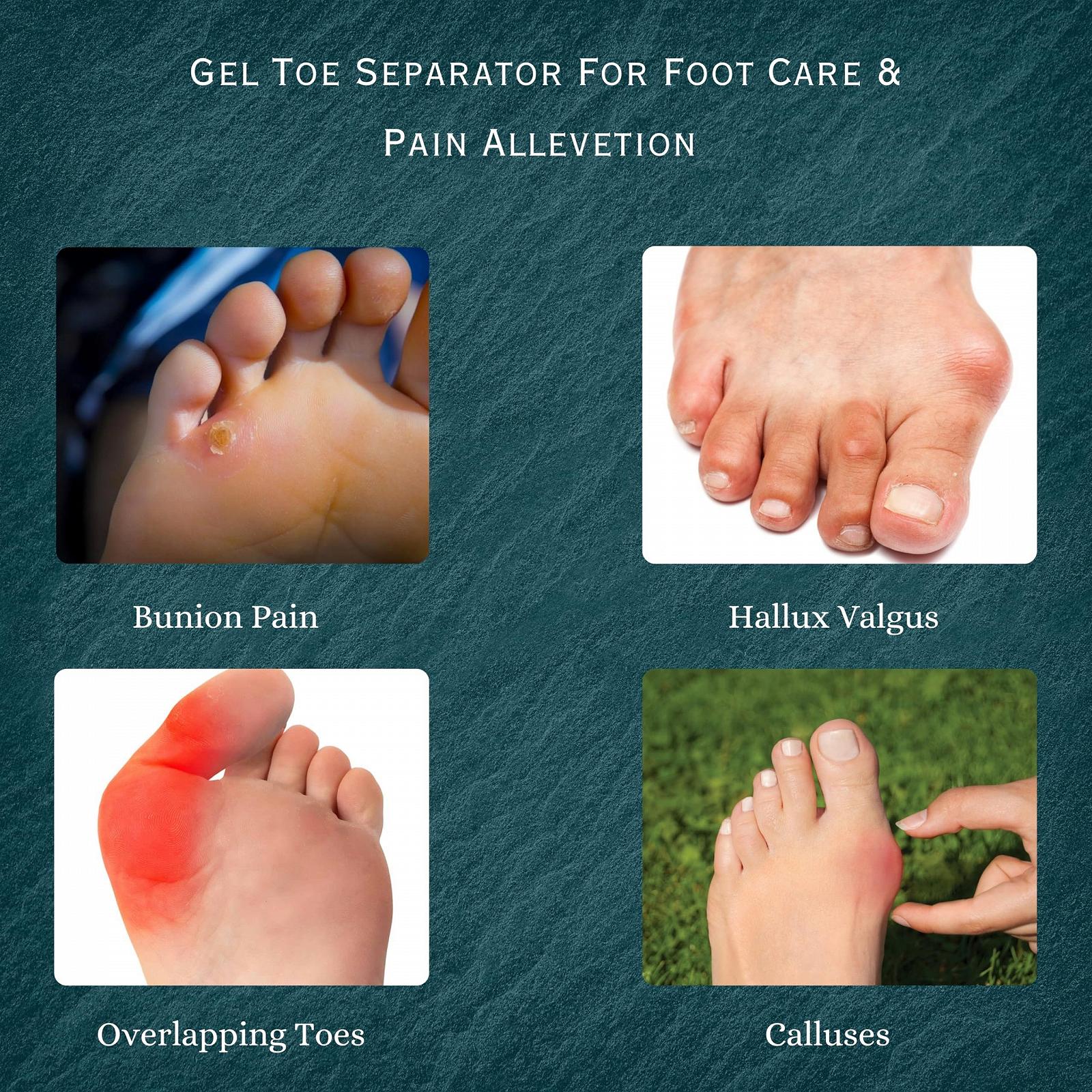 Роздільник для пальців ніг Wonder Care Силіконовий Гелеві подушечки, фото №5