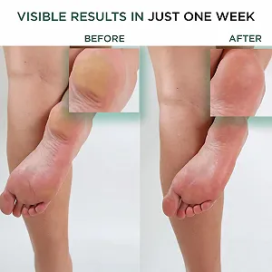 Крем для ног Walk the Walk Propolis synthetic.ua - Фото 1