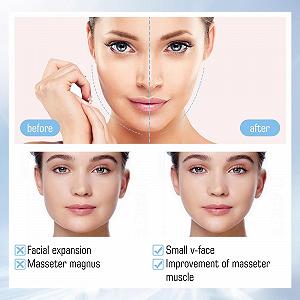 Маска для лица V-образная для лифтинга лица 5 шт Увлажняющая для подтяжки и упругости кожи synthetic.ua - Фото 1