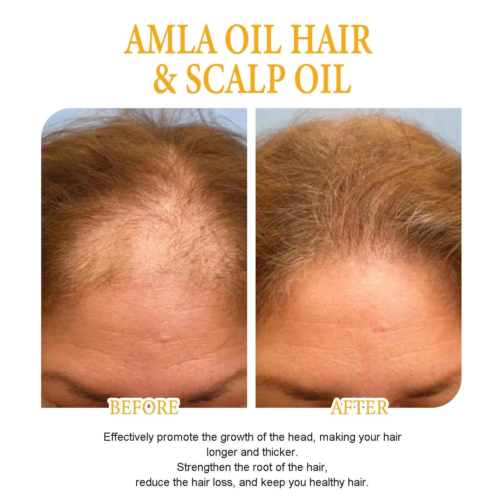 Спрей для росту волосся з біотином Biancat зволожуючий, фото №4