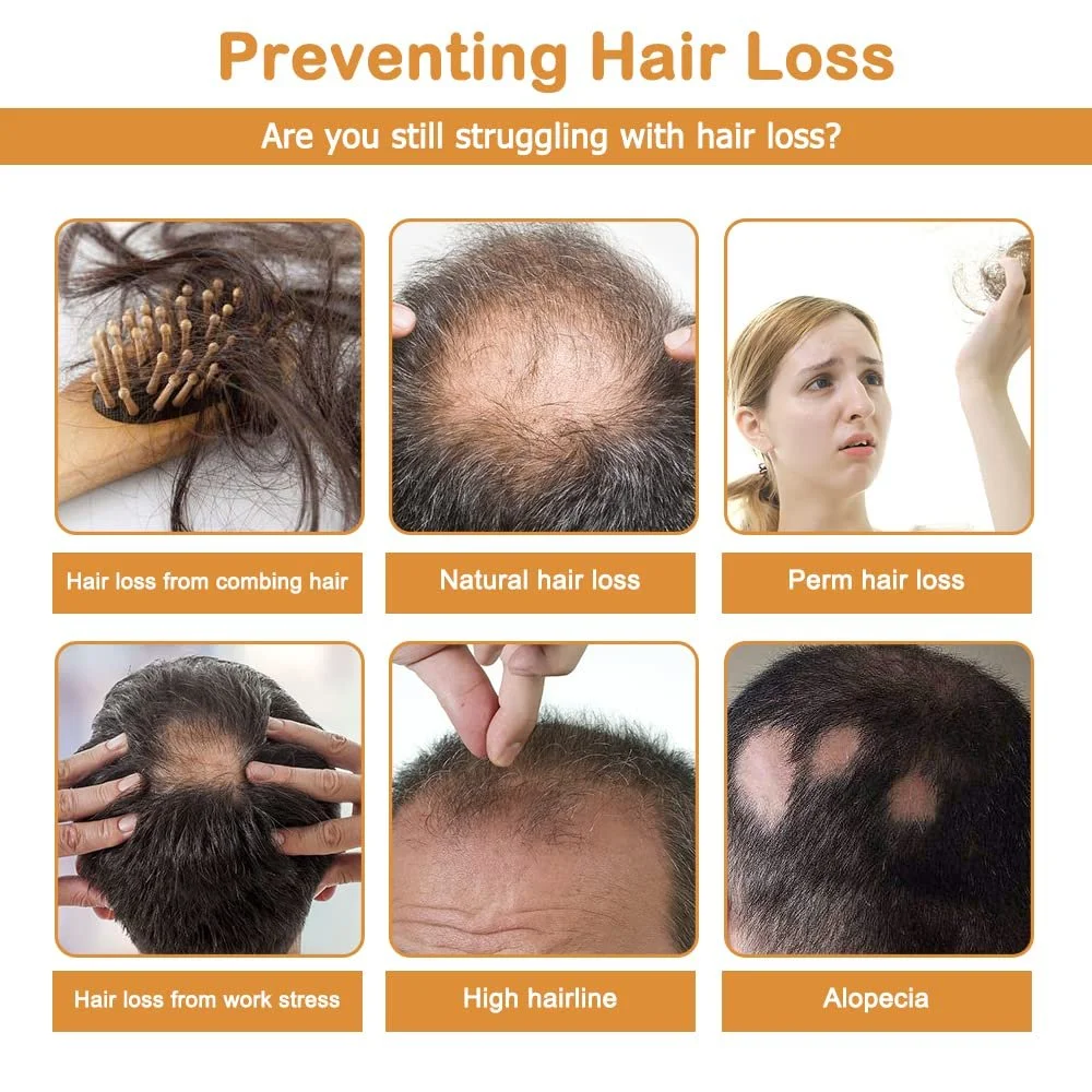 Сироватка KUIRUNRX Fermented Rice Water, Рисова вода для росту волосся, фото №4