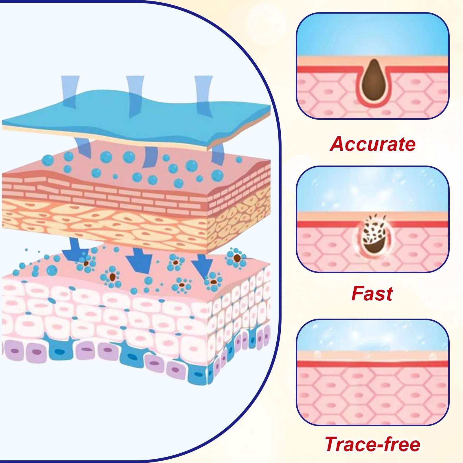 Крем для видалення бородавок Plantar Warts Removal Cream натуральні інгредієнти, 20 г, фото №4