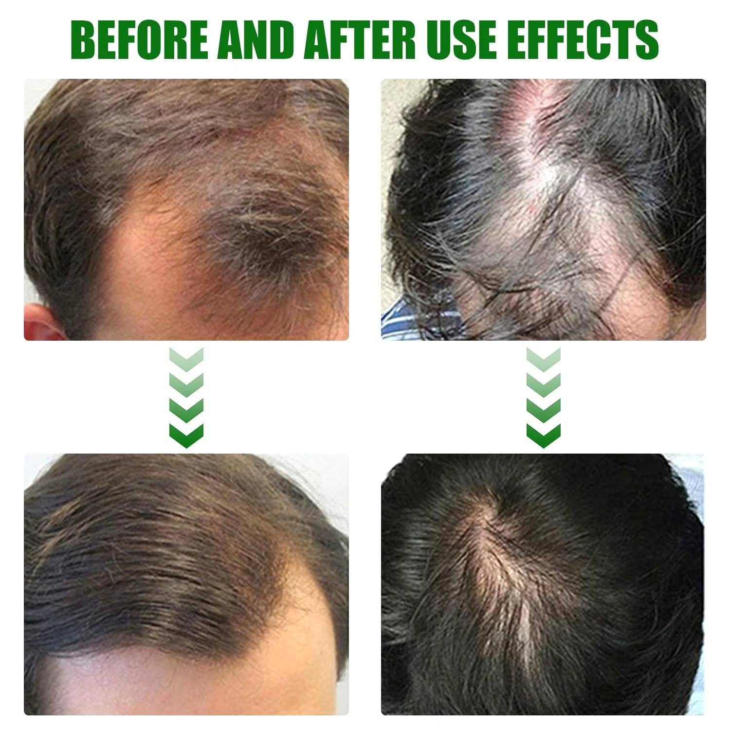 Спрей Імбирний Живильний для Стимуляції Росту Волосся Сироватка проти Випадіння, фото №6 Спрей Імбирний Живильний для Стимуляції Росту Волосся Сироватка проти Випадіння, фото №6