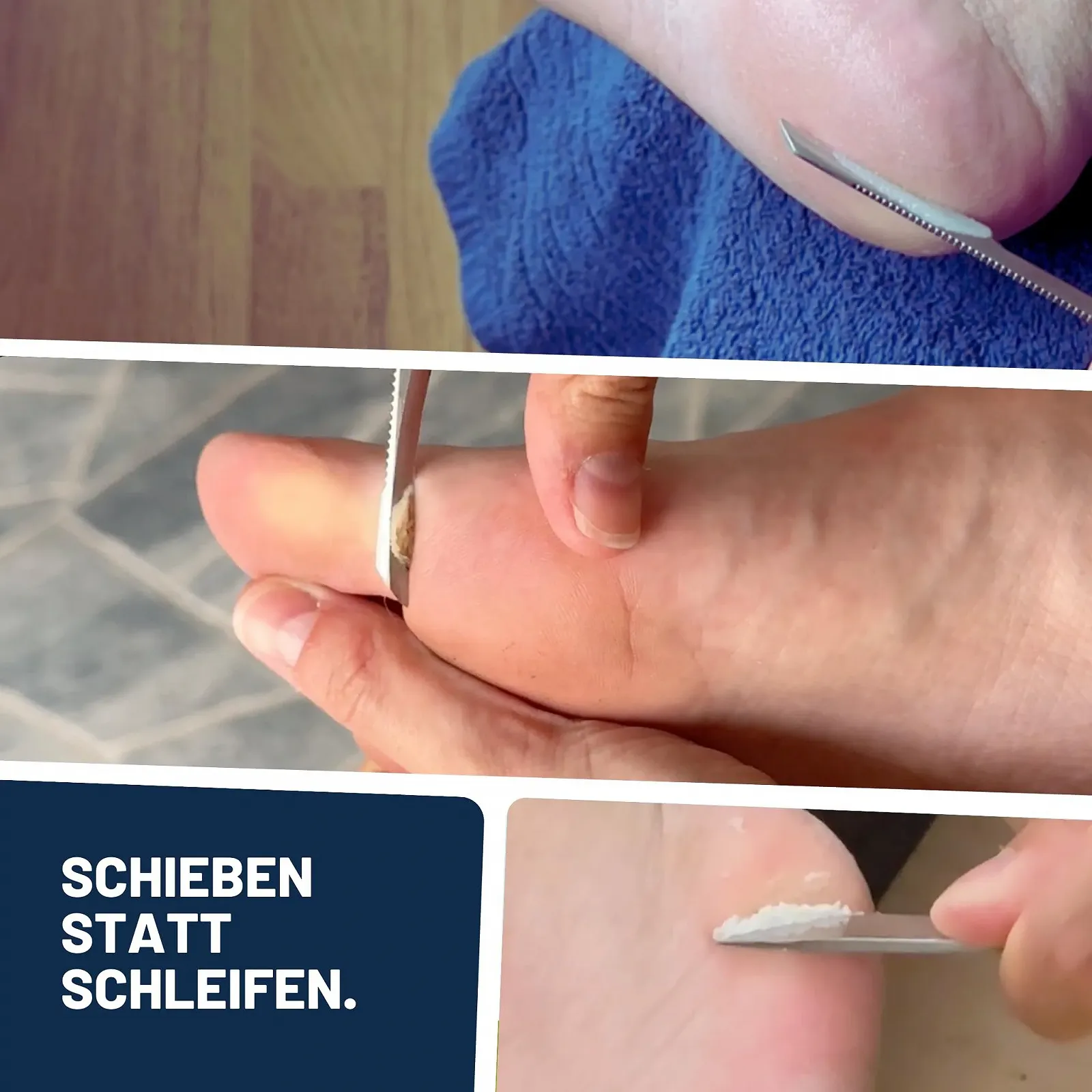 Набор для ухода за руками и ногами Mr. Fuss № 4 Advanced Pack для удаления мозолей и кутикулы 4 предмета, фото №4