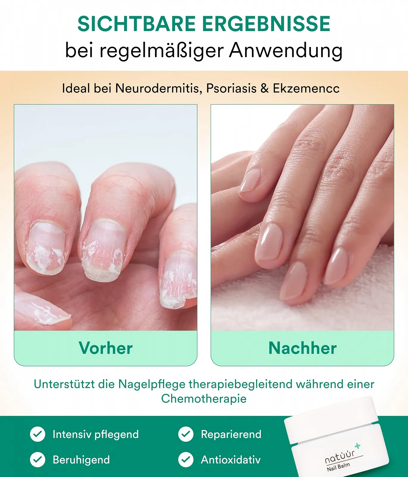 Бальзам для нігтів NeemAVERA з екстрактом німу 15 мл, фото №4