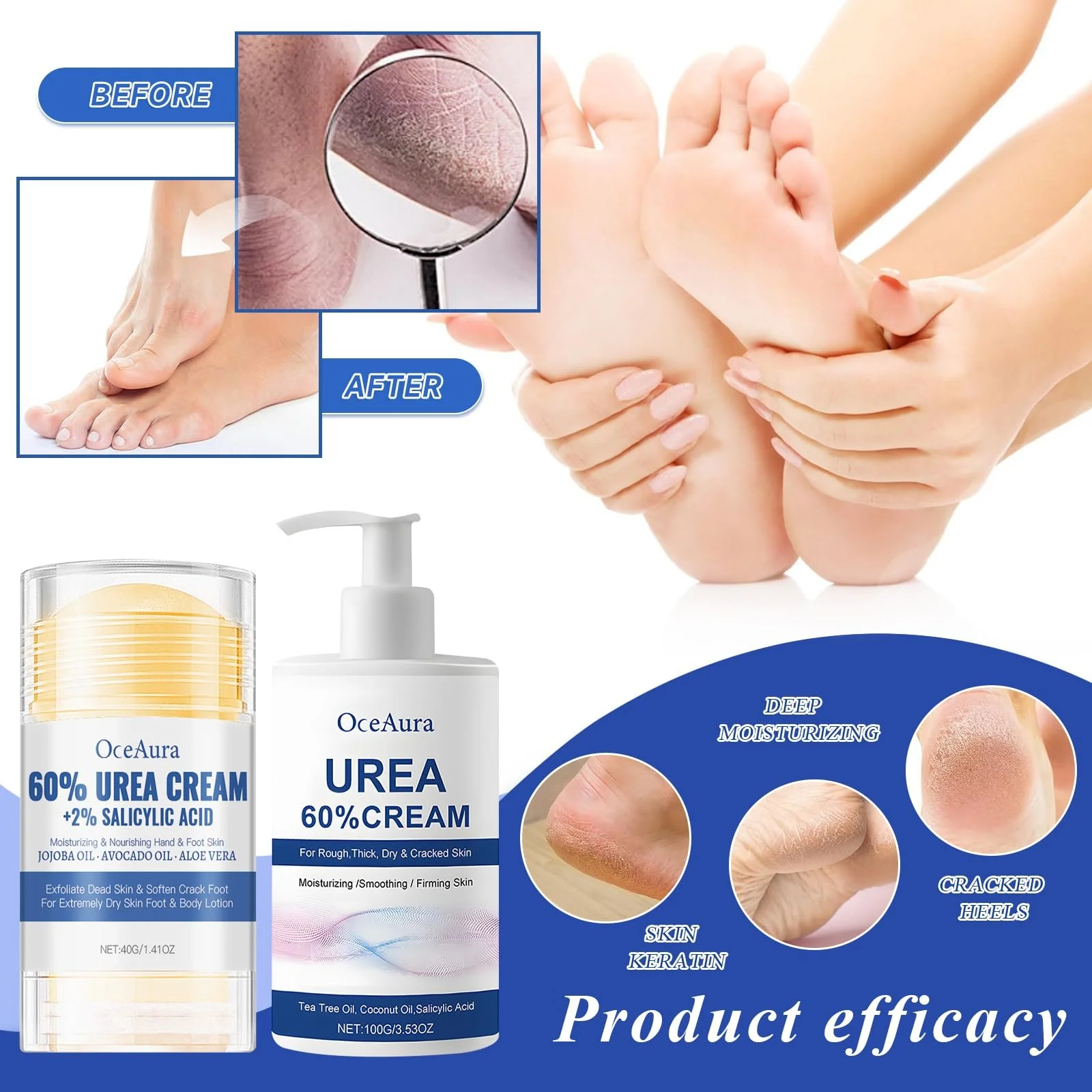 Крем для ног Urea Cream 60% увлажняющий и восстанавливающий 100 г + 40 г стик, фото №5