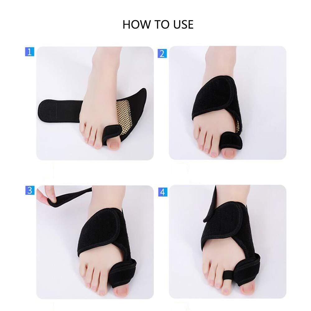 Корректор вальгусной деформации Большого Пальца, фото №4 Корректор вальгусной деформации Большого Пальца, фото №4