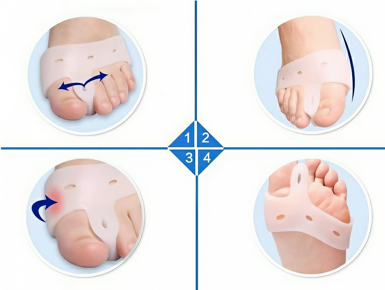 Роздільники для пальців ніг від вальгусної деформації, фото №2