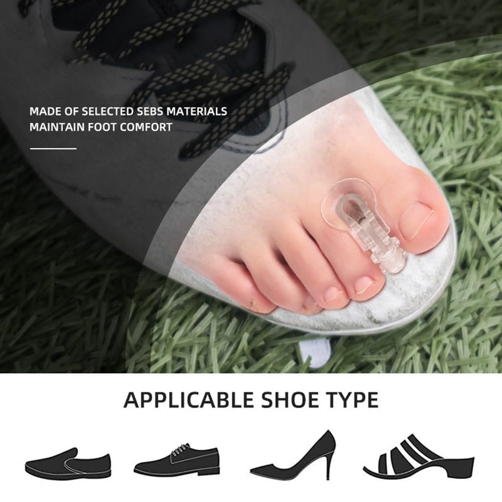 Роздільник для пальців ніг 10 шт Гелеві ортопедичні засоби для корекції вальгусної деформації, фото №2