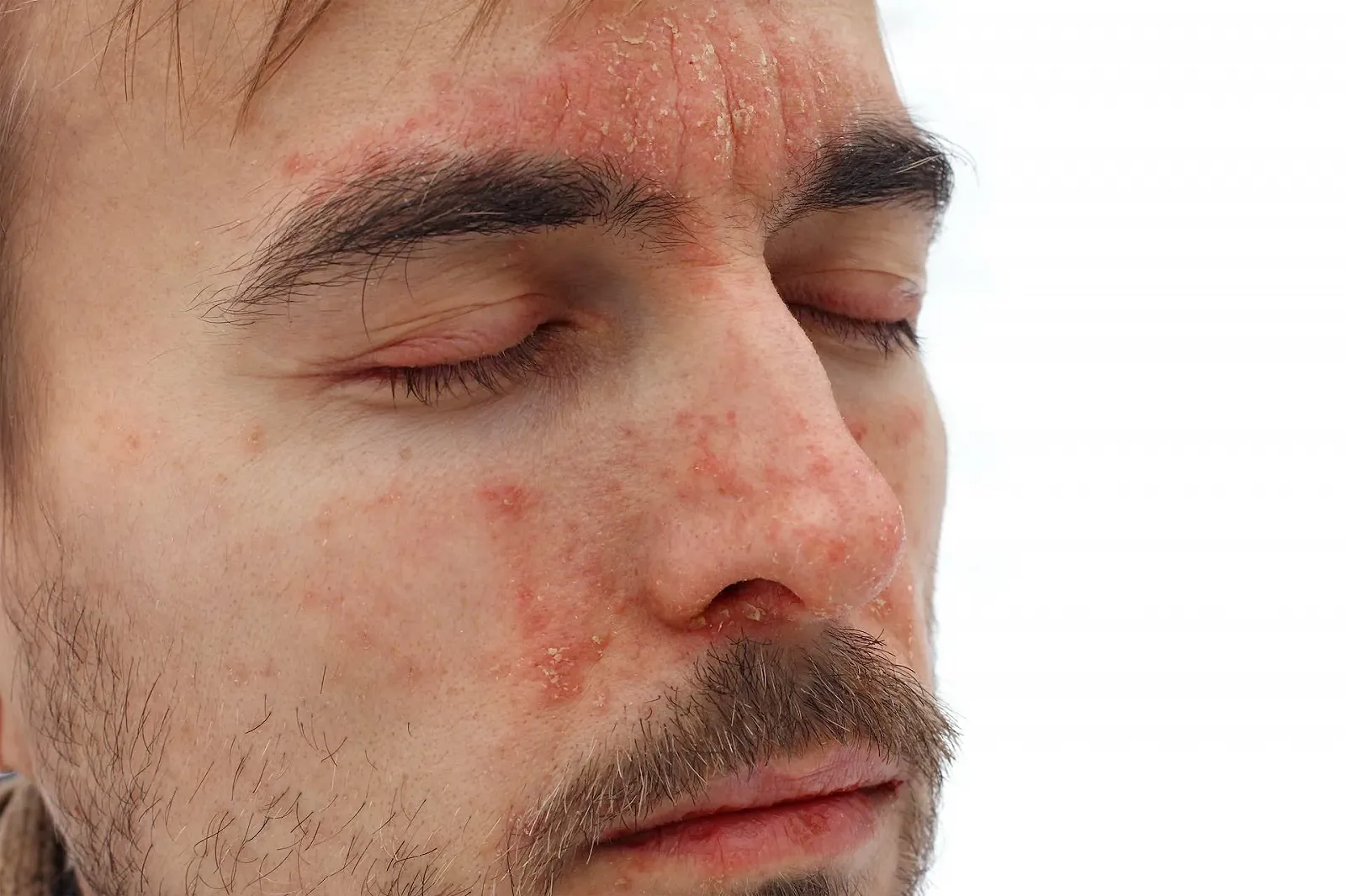 Зволожувальний крем для обличчя YOONIC SPF 20 Гіпоалергенний 50 мл, фото №6 Зволожувальний крем для обличчя YOONIC SPF 20 Гіпоалергенний 50 мл, фото №6