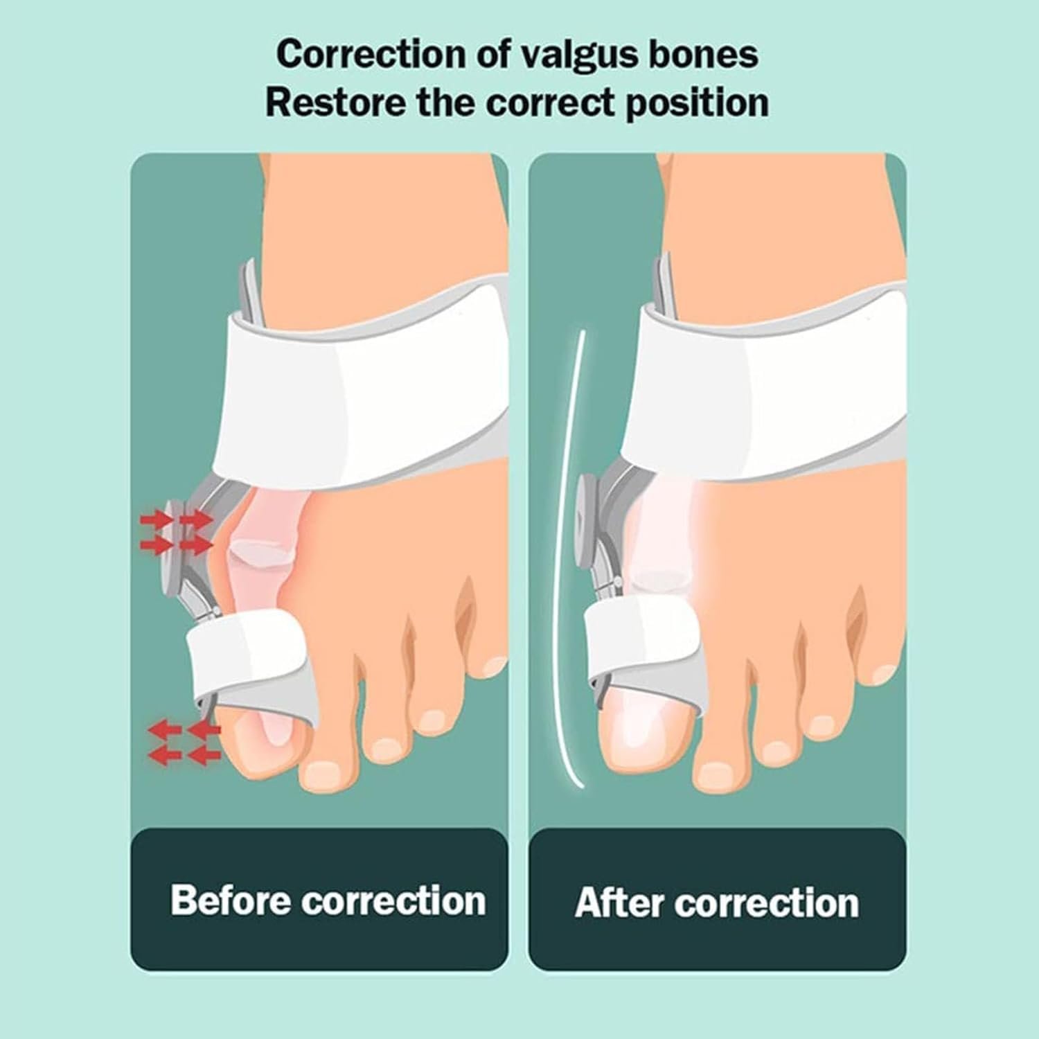 Ортез для великого пальця стопи, випрямляч, фото №6 Ортез для великого пальця стопи, випрямляч, фото №6