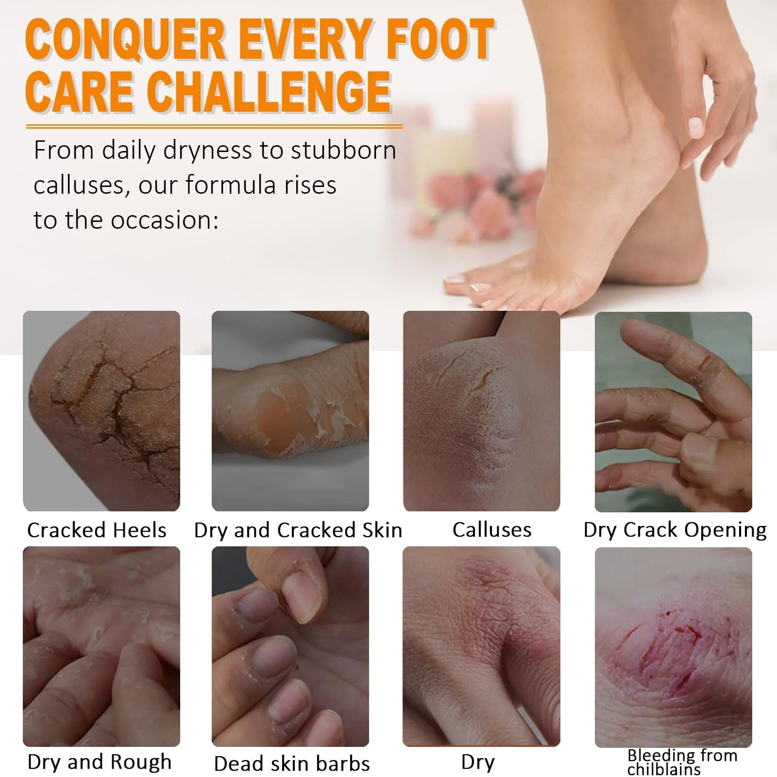 Крем для ног Ruicen Urea 60% против мозолей и трещин медовый, фото №3 Крем для ног Ruicen Urea 60% против мозолей и трещин медовый, фото №3