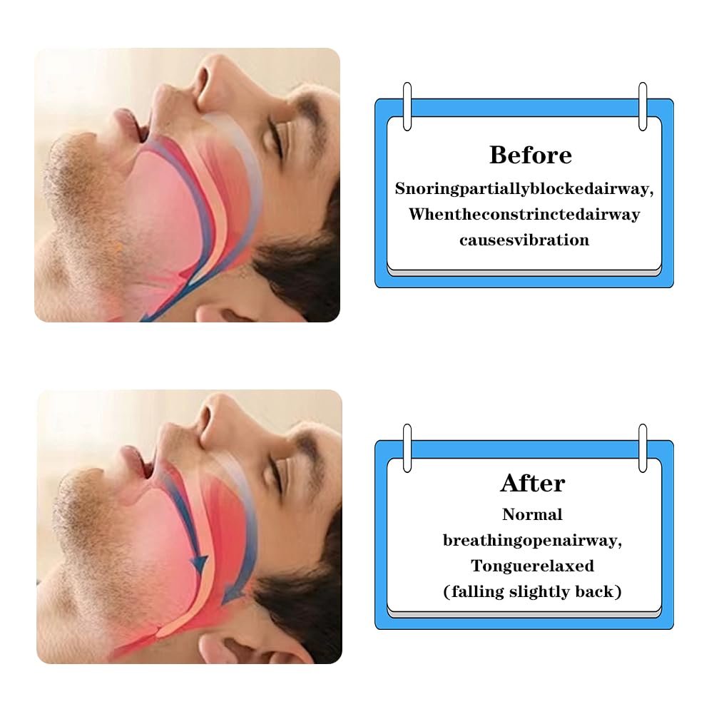 Защита от храпа, фото №5