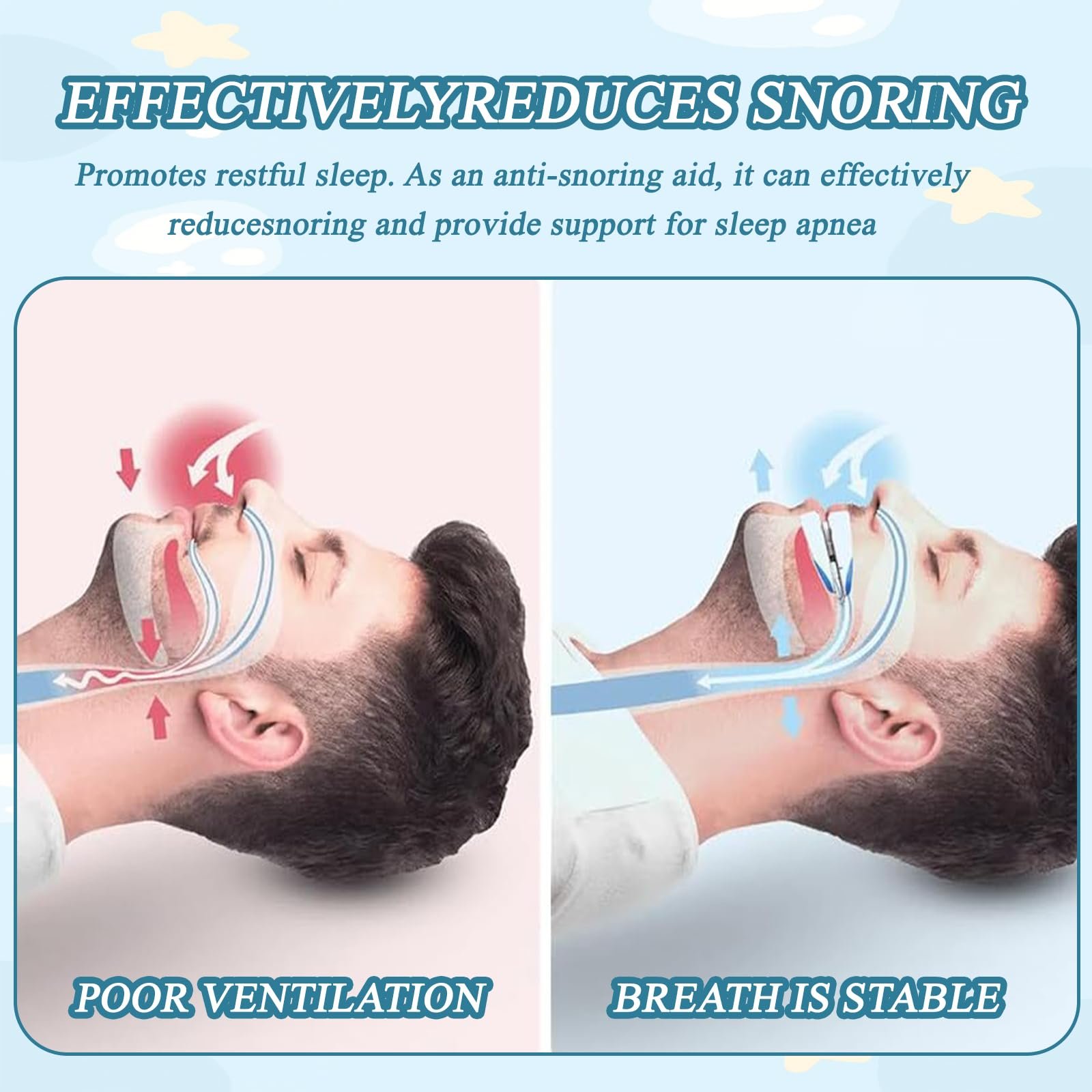 Шина від хропіння Анти-хропіння Капа, фото №3 Шина від хропіння Анти-хропіння Капа, фото №3