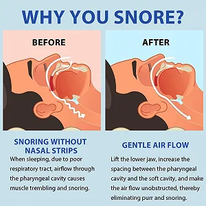 Нічна шина Crunch Splint проти хропіння та скреготу зубами, багаторазова, протихропіння для жінок та чоловіків, комфортний сон synthetic.ua - Фото 1