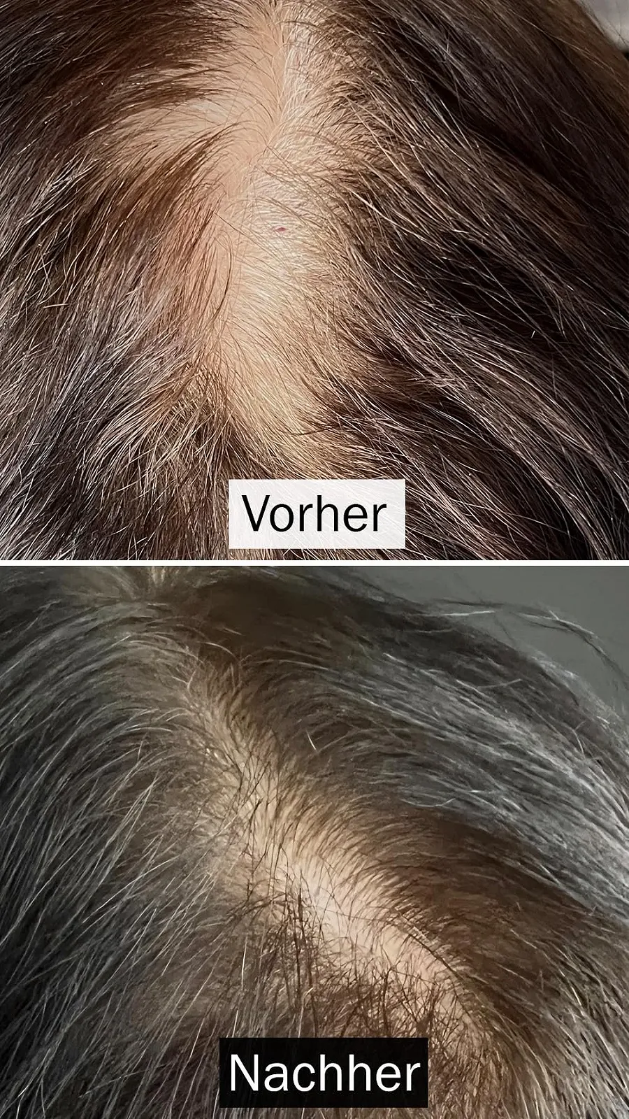 Сироватка для волосся KIND OF ROSY для густоти та росту - Веганська та 100% натуральна, фото №3 Сироватка для волосся KIND OF ROSY для густоти та росту - Веганська та 100% натуральна, фото №3