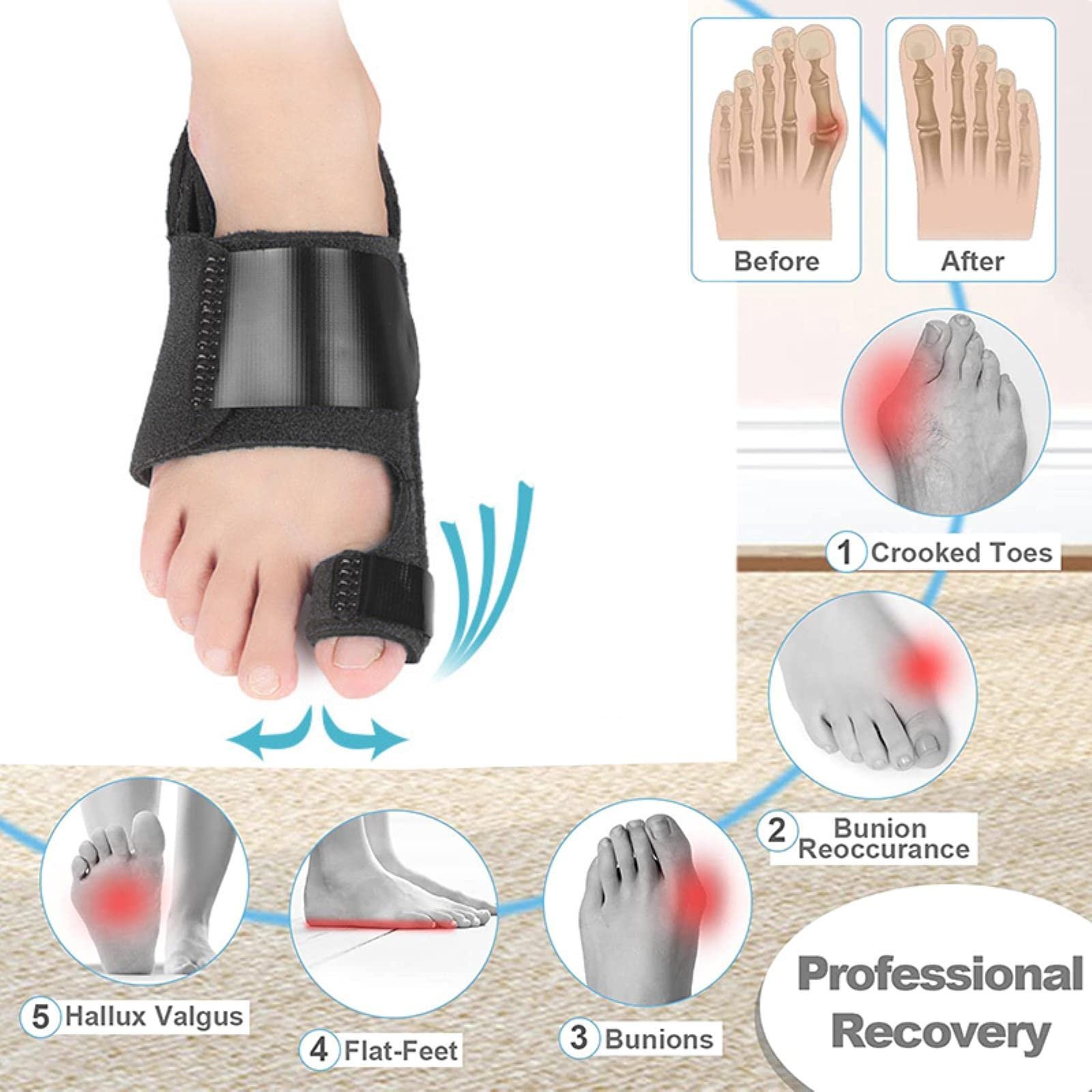 Коректор великого пальця стопи Захист від болю Hallux Valgus Bunion Splint Подушка для ніг Bunion Support, фото №2