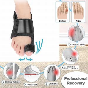 Коректор великого пальця стопи Захист від болю Hallux Valgus Bunion Splint Подушка для ніг Bunion Support synthetic.ua - Фото 1