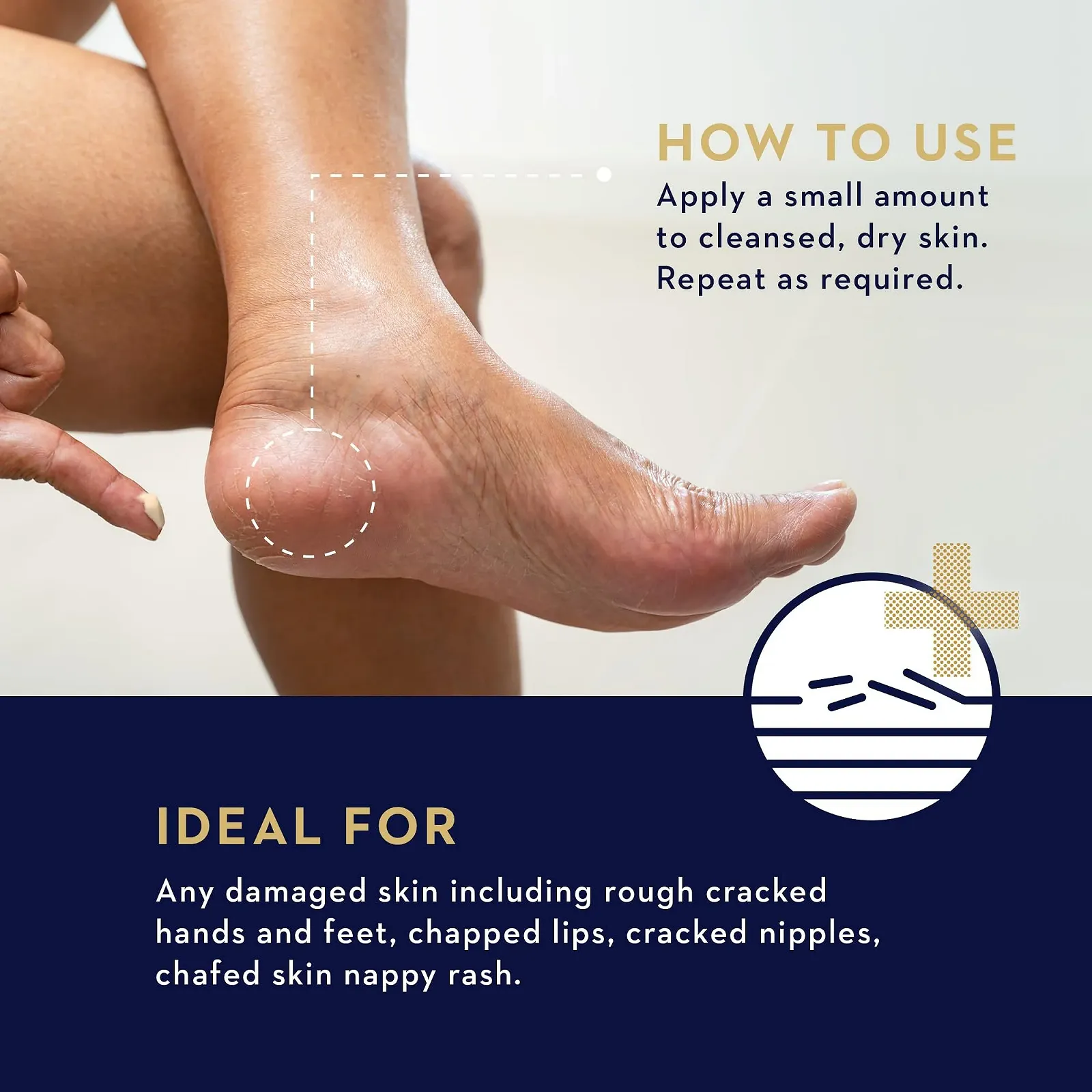 Бальзам Manuka Health Manuka Rescue, 50 мл, фото №4