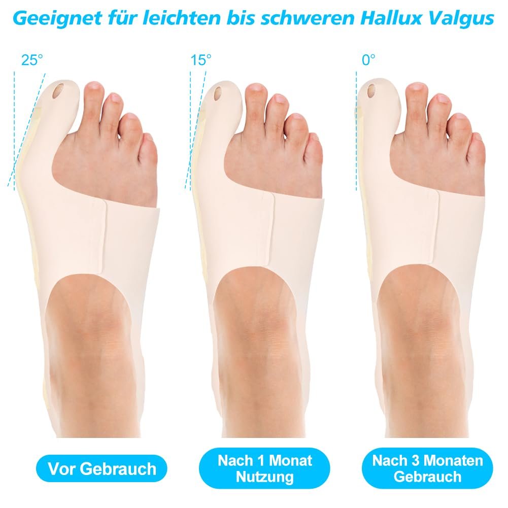 Коректор Hallux Valgus Регульований Hallux Valgus Бандаж з нековзним ремінцем на п'яті L, фото №3