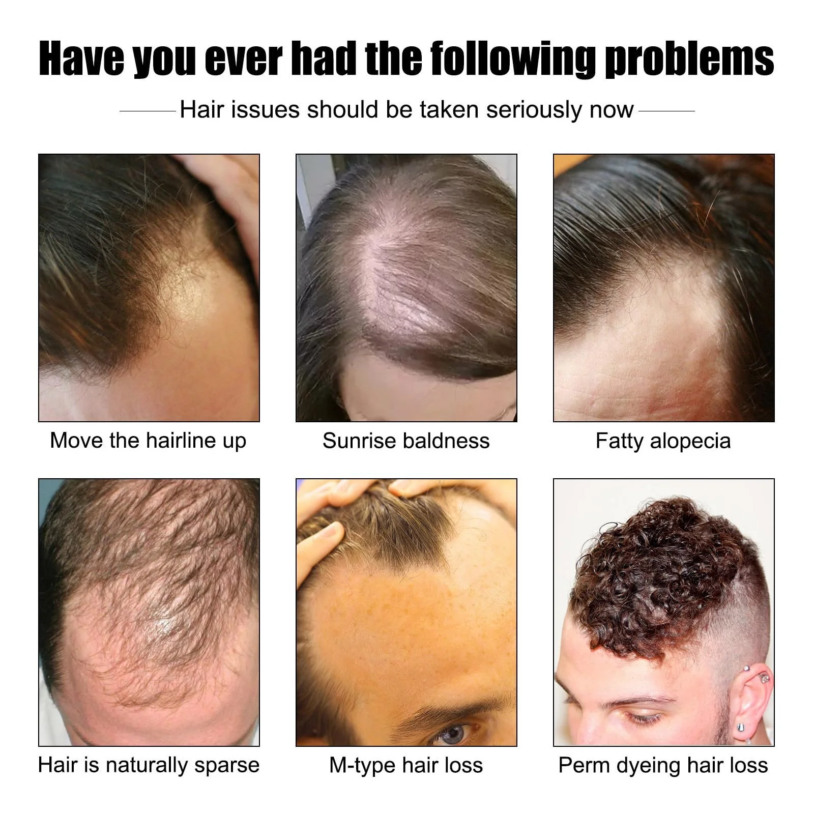 Сироватка KOAHDE для росту волосся проти випадіння, есенція олії для росту волосся, фото №4 Сироватка KOAHDE для росту волосся проти випадіння, есенція олії для росту волосся, фото №4