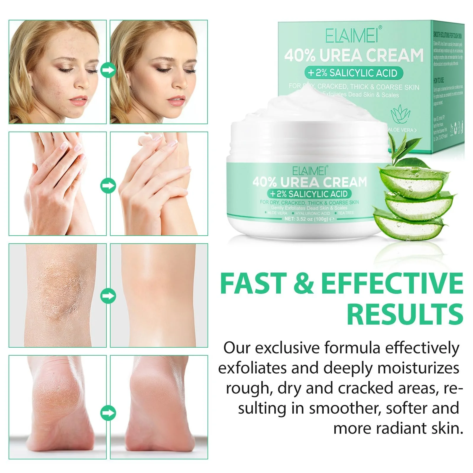 Крем для ног Urea Cream 40% Plus с 2% салициловой кислотой увлажняющий для стоп и рук 100 г, фото №2