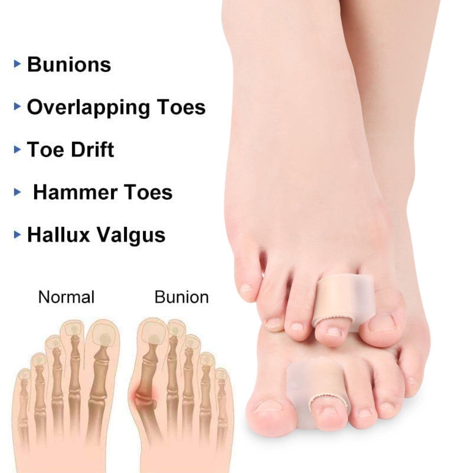 Роздільники для пальців ніг Коректор для вальгусної деформації великого пальця стопи з м’якою гелевою підкладкою, фото №5