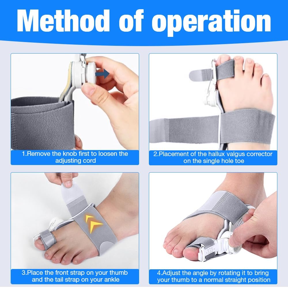 Шина для коррекции Hallux Valgus, регулируемая, обновленная, корректор большого пальца стопы, фото №3