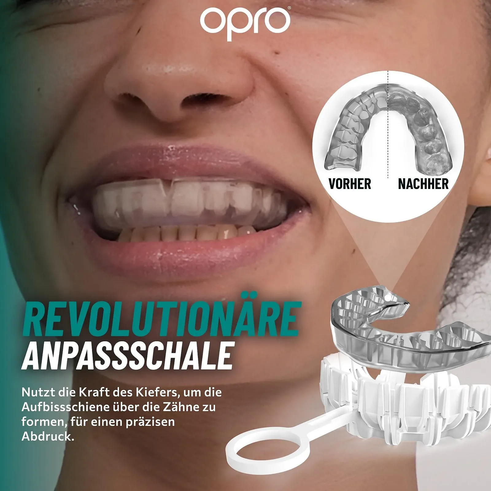 Капа для захисту від бруксизму OPRO Індивідуально регульована, зручна, гнучка, без BPA, фото №4 Капа для захисту від бруксизму OPRO Індивідуально регульована, зручна, гнучка, без BPA, фото №4