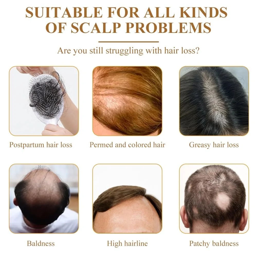 Сироватка KUIRUNRX для росту волосся з біотином, 2 шт, 30 мл, фото №6